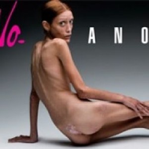 anorexia