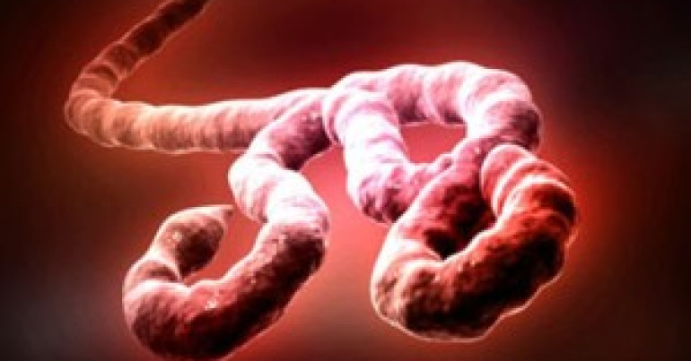 #116 Emerging Viruses 6° : Ebola Virus